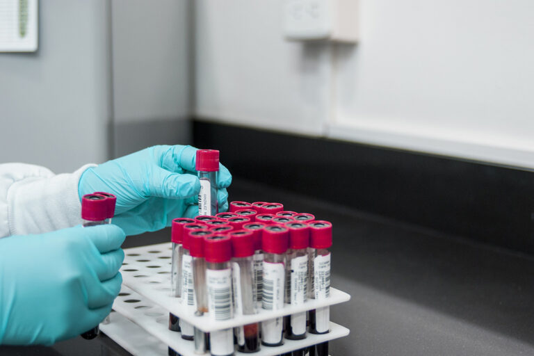 New Blood Test Offers Promising Alternative for Colon Cancer Screening