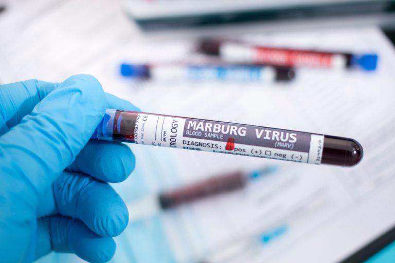 Marburg Virus Outbreak in Rwanda Sparks Global Race for Vaccine Trials