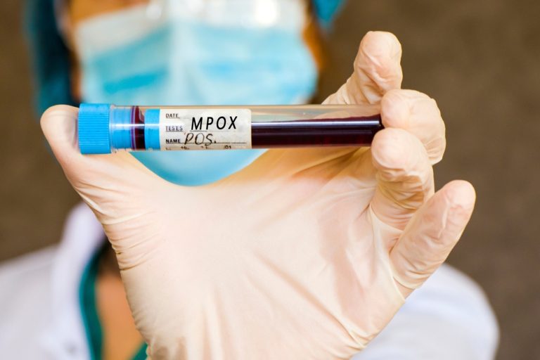 Germany Detects First Case of New Mpox Variant: Risk Remains Low