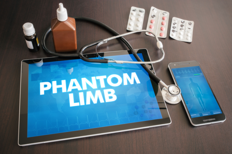 Study Reveals Why Phantom Limbs Persist