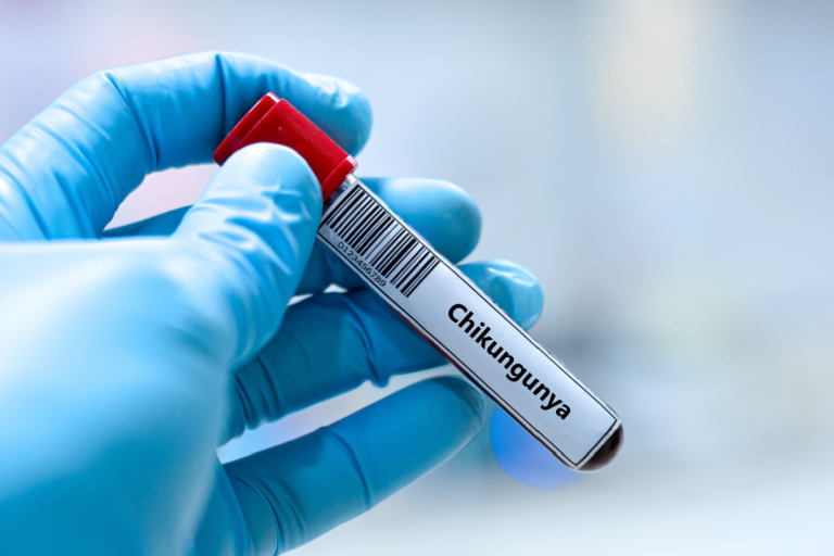 New York Reports First Local Chikungunya Case Since 2019