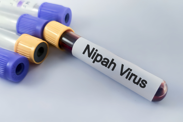 Nipah virus outbreak prompts airport screenings in Asia